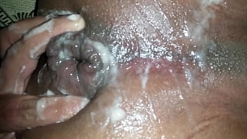 Anal cream Anal cream