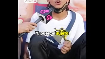 La historia detrás de mis cicatrices #vertigo #elchicletv #vida #chiclenoticias #patinetas #deporte #atrevidoypegajoso