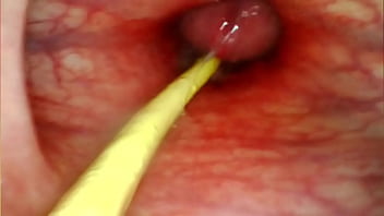 Extreme anal pov camera inside her asshole as i pound her with my big cock and cum deep inside