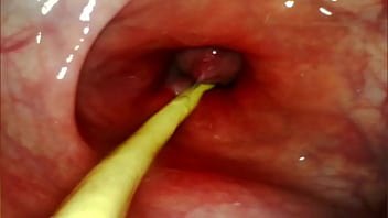 Extreme anal pov camera inside her asshole as i pound her with my big cock and cum deep inside