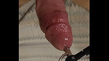 peehole anale