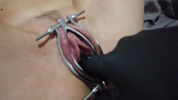 creampie speculum