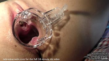 swollen pussy prolapse pee girls porn