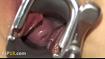 Camera deeply in her gaped vagina vagina