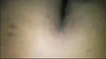 Sores on her ass since 2010
