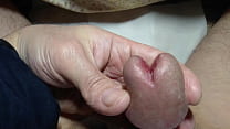 old man foreskin part3