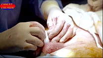 My Enlargement Surgery (Penile Girth and Length Surgery) for £8495