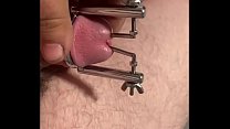 Urethra open