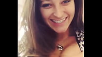 Monica  ngaTexas  duke treguar cicat e sajë të shishme në kamer
