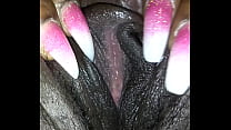 ycat onme