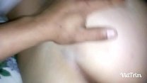20170326 7156