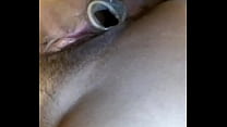 Másturbada anal