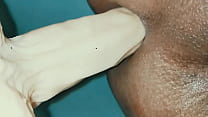 Anal001