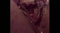 Swollen pussy