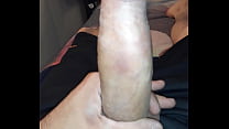My balls