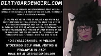 DGG self anal fisting prolapse 26.08.2025
