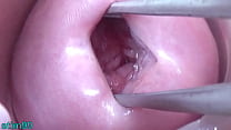 Lesbians pissing into the cervix of the other one directly since her pee hole