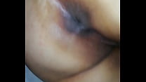 Anal fat