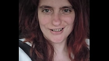 Chloecoquine update #20 aug 10 2024