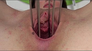 1 Gyno Gaping Of Beautiful Belarusian Model 2014 09 19 22 11 046 thumbnail