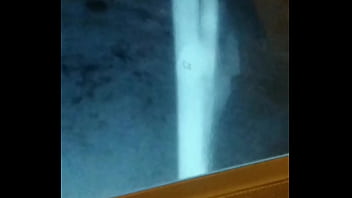 La espió mientras pasea su perro