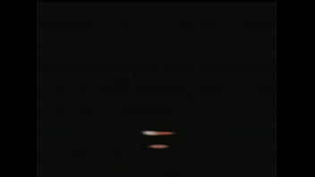 Welcome to rectal rooter