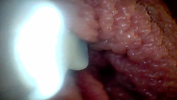 Endoscope Camera Shows The Most Sensitive Parts Of The Penis Educational Video thumbnail
