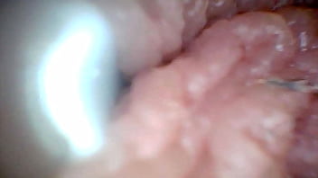 Endoscope camera shows the most sensitive parts of the penis educational video