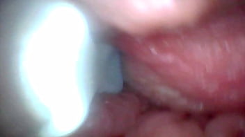 Endoscope camera shows the most sensitive parts of the penis educational video