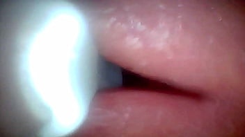 Endoscope camera shows the most sensitive parts of the penis educational video