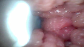 Endoscope camera shows the most sensitive parts of the penis educational video