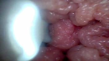 Endoscope camera shows the most sensitive parts of the penis educational video