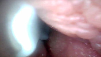 Endoscope camera shows the most sensitive parts of the penis educational video