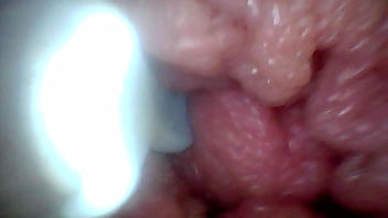 Endoscope camera shows the most sensitive parts of the penis educational video Endoscope camera shows the most sensitive parts of the penis educational video