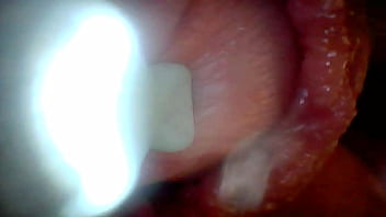 Endoscope camera shows the most sensitive parts of the penis educational video