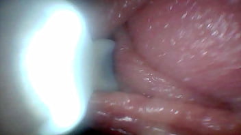 Endoscope camera shows the most sensitive parts of the penis educational video
