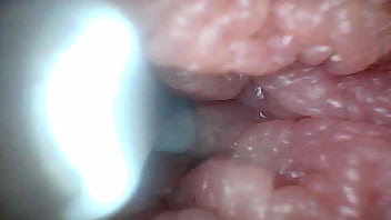 Endoscope camera shows the most sensitive parts of the penis educational video