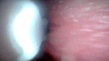 Endoscope camera shows the most sensitive parts of the penis educational video