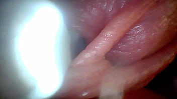 Endoscope camera shows the most sensitive parts of the penis educational video