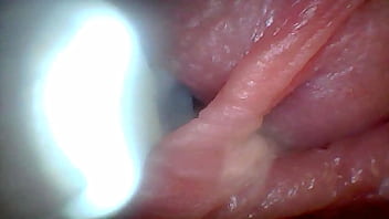 Endoscope camera shows the most sensitive parts of the penis educational video