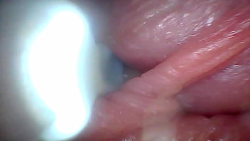 Endoscope camera shows the most sensitive parts of the penis educational video