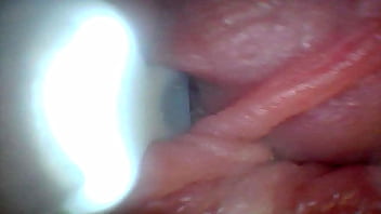 Endoscope camera shows the most sensitive parts of the penis educational video