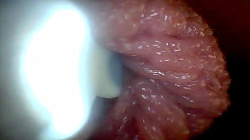 Endoscope camera shows the most sensitive parts of the penis educational video