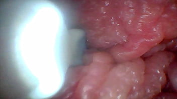Endoscope camera shows the most sensitive parts of the penis educational video