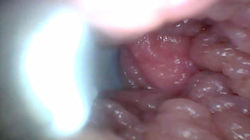 Endoscope camera shows the most sensitive parts of the penis educational video Endoscope camera shows the most sensitive parts of the penis educational video