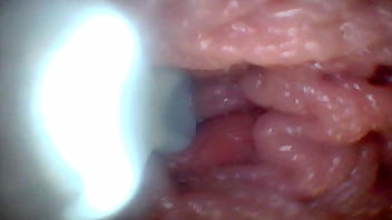 Endoscope camera shows the most sensitive parts of the penis educational video Endoscope camera shows the most sensitive parts of the penis educational video