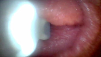 Endoscope camera shows the most sensitive parts of the penis educational video