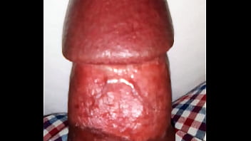Penis Examination thumbnail