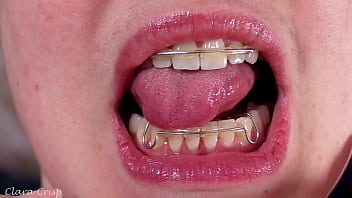 Tempting you into cumming on my retainers bbw milf mouth