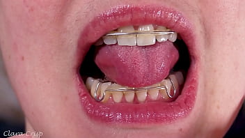 Tempting you into cumming on my retainers bbw milf mouth